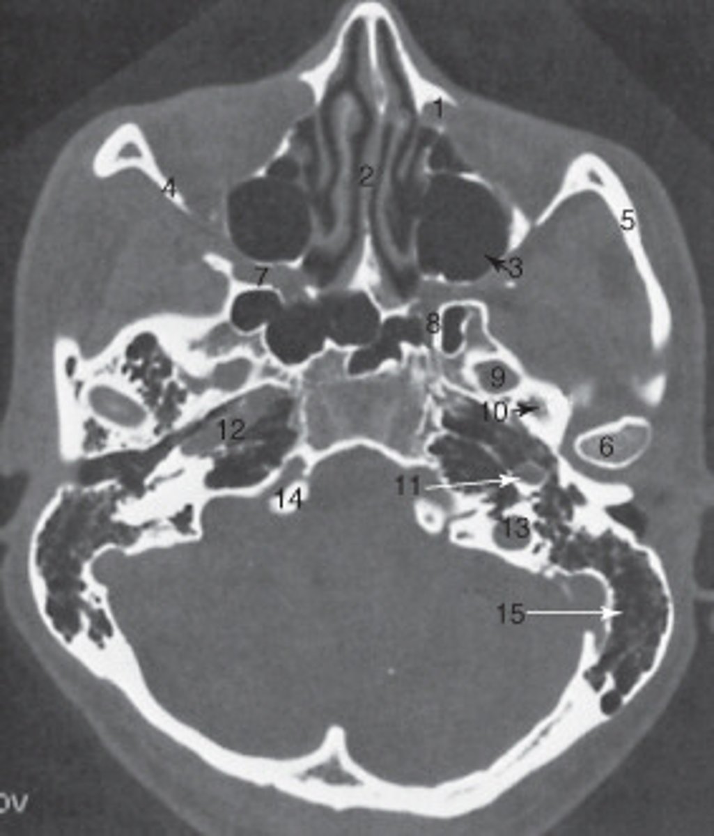 <p>the nasal septum is labeled:</p>