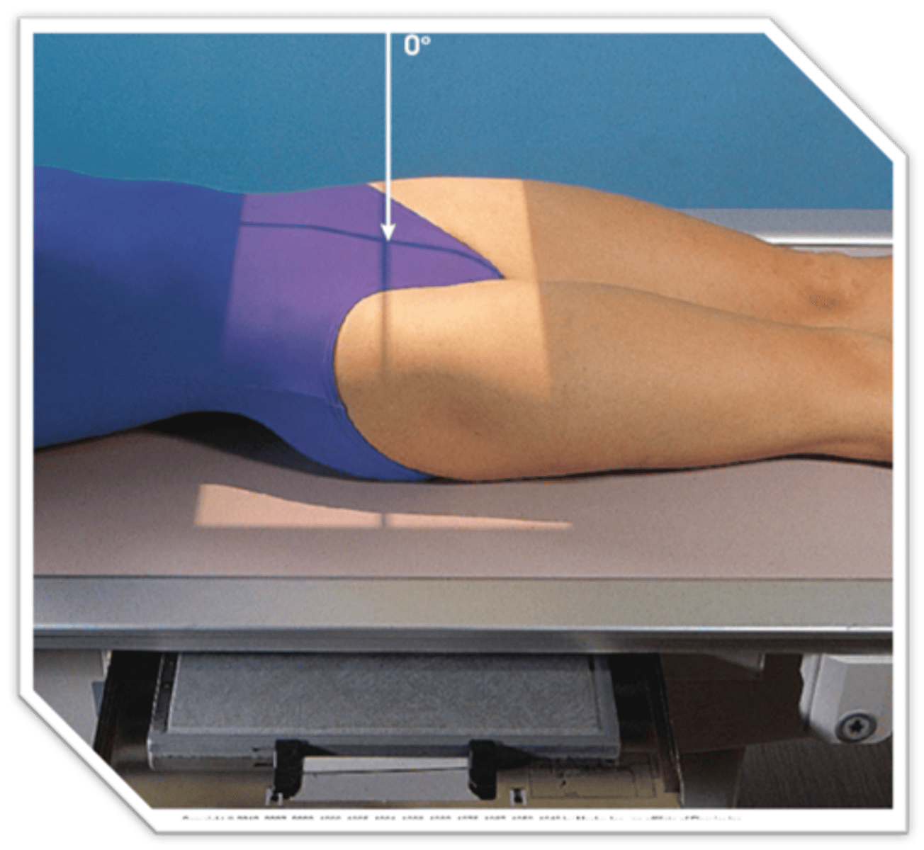 <p>CR perpendicular and 1/2 way btwn the pubic symphysis and the ASIS at the MSP.</p>