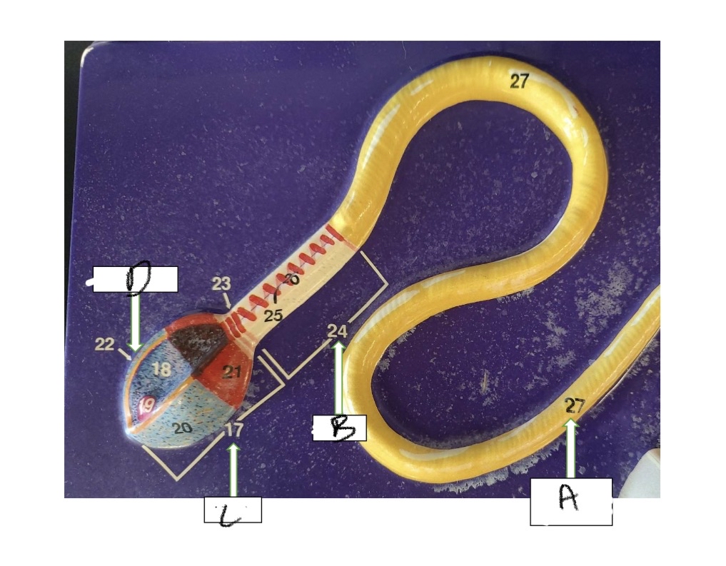 <p>What is structure A</p>