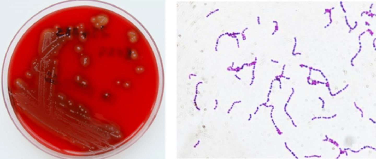 <p>beta hemolytic (large zone)</p><p>grey pigment</p><p>small colony</p><p>cocci in chains</p>